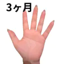 3ヶ月経過