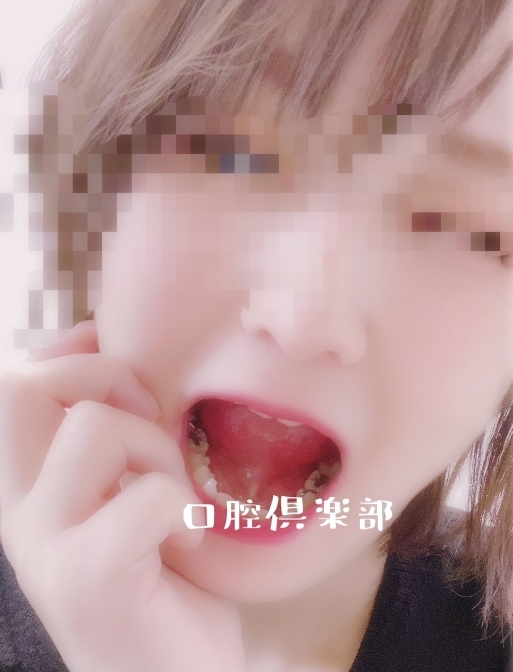 銀歯AV女優画像 銀歯】 じゅりさん ※上位プランの旧作です（同一内容） 🦷口腔倶楽部👄 (のっぽ)の商品｜ファンティア[Fantia]