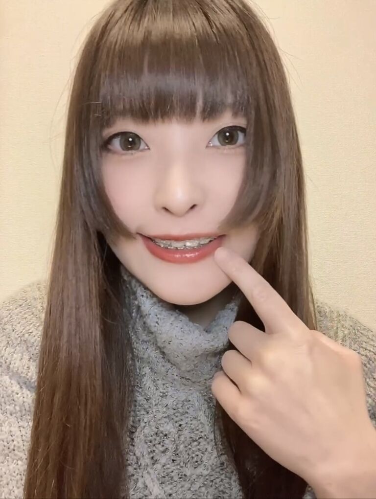 3月調整とリテーナー相談
