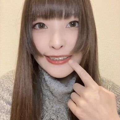 3月調整とリテーナー相談