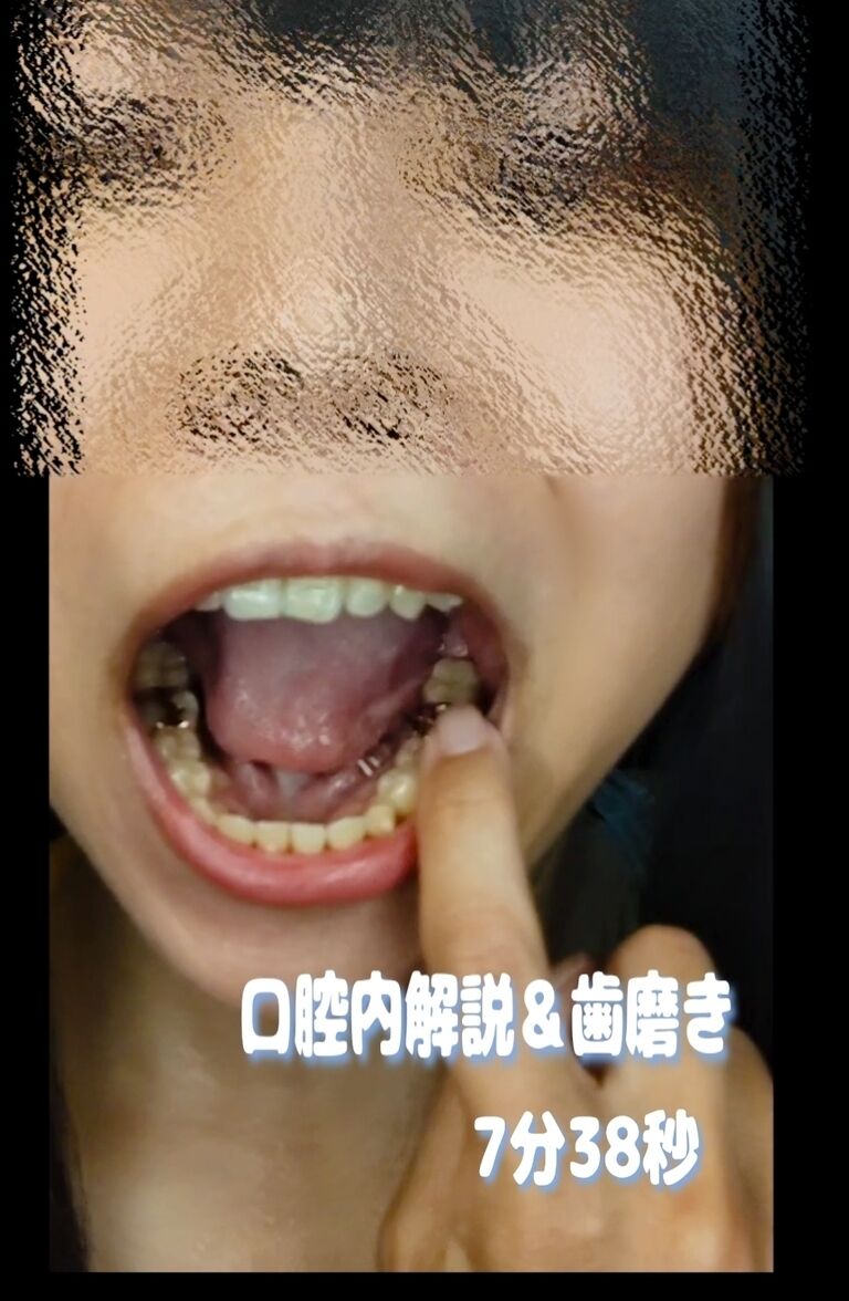 矯正美人の口腔フェチ ~歯磨きとフロスの誘惑~