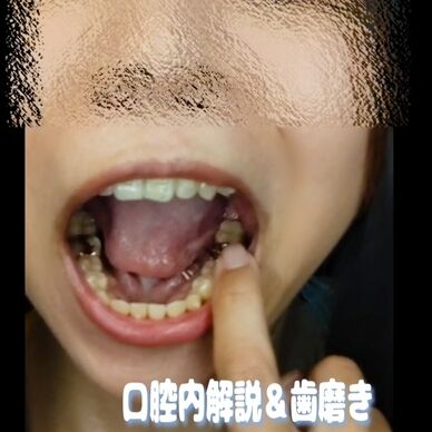 矯正美人の口腔フェチ ～歯磨きとフロスの誘惑～