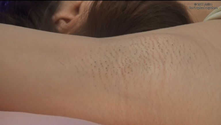 28歳　あきさんの心音集（水着Ver）Vol.2