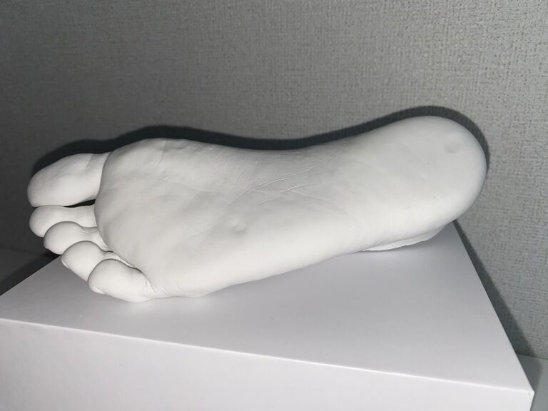 石膏 右足(訳あり)