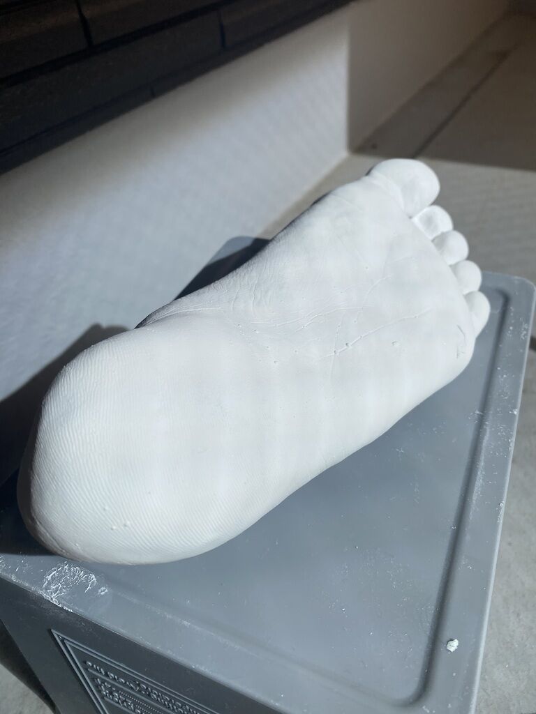 石膏 左足❷