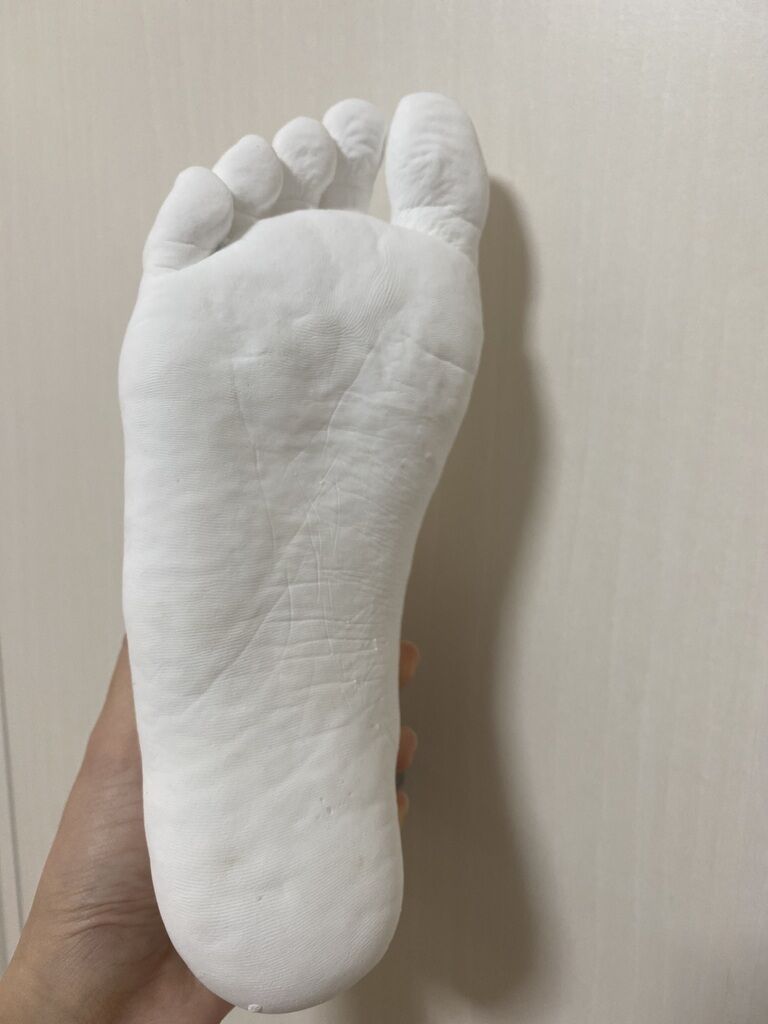 石膏 右
